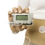 Insulin Pump Therapy